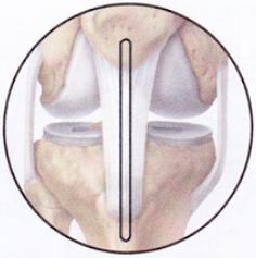 Round Image 1